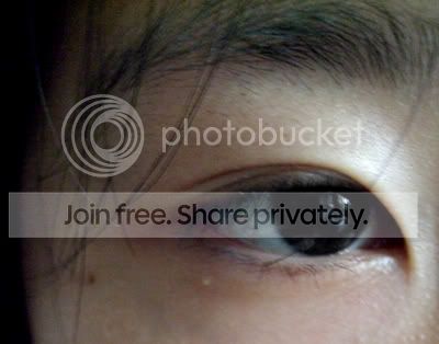 晒一下右眼的泪痣.我很喜欢富江同学